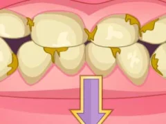 Gra Bad Teeth Makeover w Internecie