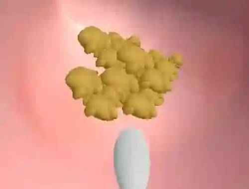 Gra Earwax Clinic w Internecie