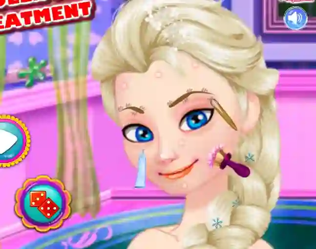 Gra Ice Queen Acne Treatment w Internecie