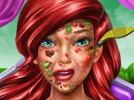 Gra Princess Mermaid Skin Doctor w Internecie