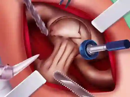Gra Princess Hips Surgery w Internecie